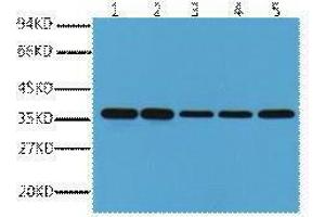 Western Blotting (WB) image for anti-Glyceraldehyde-3-Phosphate Dehydrogenase (GAPDH) antibody (ABIN3187999) (GAPDH antibody)