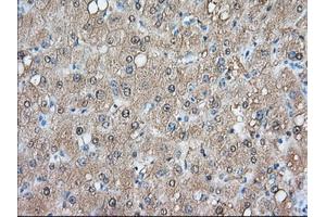 Immunohistochemical staining of paraffin-embedded Human liver tissue using anti-ACAT2 mouse monoclonal antibody.