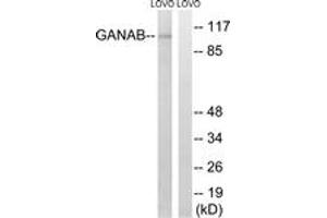 Western blot analysis of extracts from LOVO cells, using GANAB Antibody. (GANAB antibody  (AA 242-291))