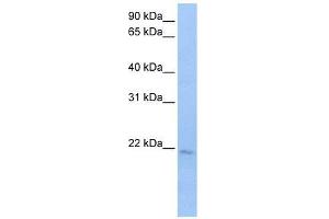 SPATA12 antibody used at 0. (SPATA12 antibody  (N-Term))