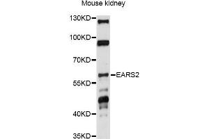 Western blot analysis of extracts of mouse kidney, using EARS2 antibody (ABIN6293105) at 1:1000 dilution.