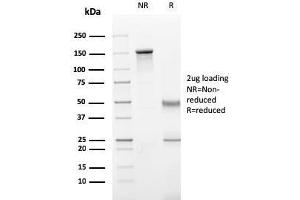 SDS-PAGE Analysis Purified Perforin-1 Monospecific Mouse Monoclonal Antibody (PRF1/2470). (Perforin 1 antibody  (AA 413-552))