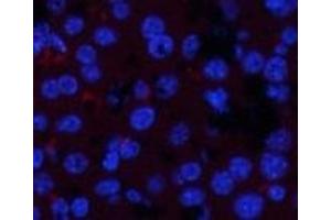 Immunofluorescence analysis of Mouse liver tissue with Phospho-JAK1 (Tyr1022) Polyclonal Antibody at dilution of 1:200 (JAK1 antibody  (pTyr1022))