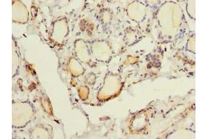 Immunohistochemistry of paraffin-embedded human thyroid tissue using ABIN7153260 at dilution of 1:100 (FYCO1 antibody  (AA 2-255))