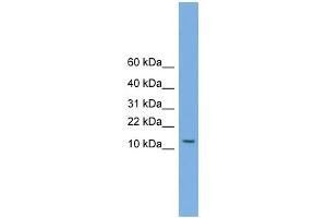 WB Suggested Anti-MAGEA5 Antibody Titration:  0. (MAGEA5 antibody  (N-Term))