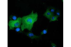 Image no. 6 for anti-DnaJ (Hsp40) Homolog, Subfamily A, Member 2 (DNAJA2) antibody (ABIN1497858) (DNAJA2 antibody)