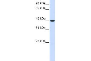 WB Suggested Anti-AGPAT5 Antibody Titration:  0. (AGPAT5 antibody  (N-Term))