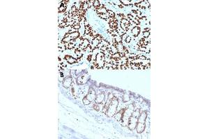 Immunohistochemical staining (Formalin-fixed paraffin-embedded sections) of human prostate carcinoma (A) and rat colon (B) with FOXA1 monoclonal antibody, clone FOXA1/1518 . (FOXA1 antibody  (AA 467-614))