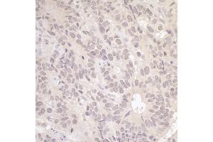 anti-Replication Factor C (Activator 1) 3, 38kDa (RFC3) (AA 80-110) antibody