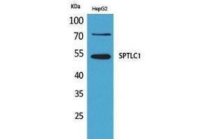 Western Blotting (WB) image for anti-serine Palmitoyltransferase, Long Chain Base Subunit 1 (SPTLC1) (C-Term) antibody (ABIN3178263) (SPTLC1 antibody  (C-Term))
