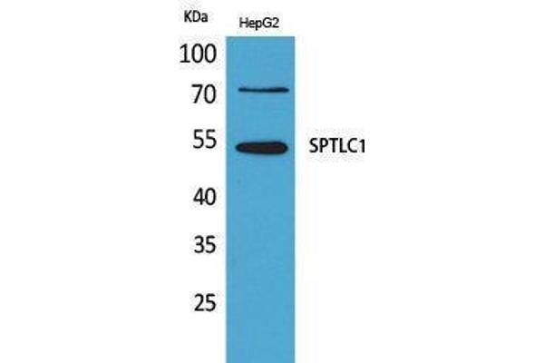 SPTLC1 抗体  (C-Term)