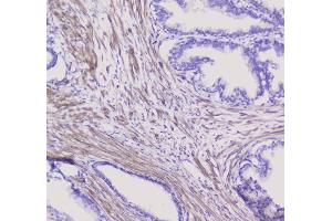 IHC analysis of NSE using anti-NSE antibody (ABIN6719549). (ENO2/NSE antibody)