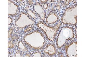IHC analysis of TTC11/FIS1 using anti-TTC11/FIS1 antibody (ABIN7600321).