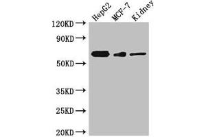Western Blotting (WB) image for anti-Vang-Like 2 (VANGL2) (AA 1-110) antibody (ABIN7175358)
