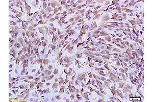 Immunohistochemistry (IHC) image for anti-Vimentin (VIM) (AA 371-466) antibody (ABIN672786)