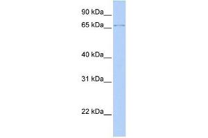 Transfected 293T; WB Suggested Anti-ZFP64 Antibody Titration: 0. (ZFP64 antibody  (N-Term))