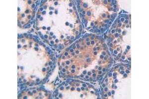 IHC-P analysis of Kidney tissue, with DAB staining. (Angiotensin I Converting Enzyme 1 antibody  (AA 334-409))