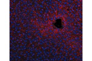 IF analysis of Apolipoprotein E/APOE using anti-Apolipoprotein E/APOE antibody (ABIN4886470).