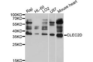 Western blot analysis of extracts of various cell lines, using CLEC2D antibody (ABIN4903312) at 1:1000 dilution. (CLEC2D antibody)