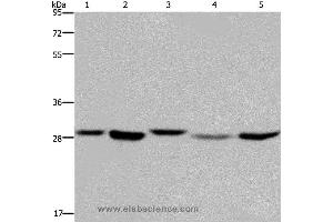Western blot analysis of 293T, MCF-7 and PC3 cell, human fetal liver tissue and Hela cell, using ECHS1 Polyclonal Antibody at dilution of 1:300 (ECHS1 antibody)