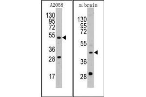 Image no. 1 for anti-Plasminogen Activator, Urokinase (PLAU) (AA 68-98), (N-Term) antibody (ABIN2853629) (PLAU antibody  (N-Term))