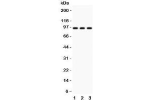 Western blot testing of TBK1 antibody and  Lane 1: HeLa;  2: rat testis;  3: rat liver;  Predicted molecular weight: ~84 kDa.