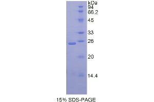 SDS-PAGE (SDS) image for Desmocollin 1 (DSC1) (AA 486-686) protein (His tag) (ABIN1877321) (Desmocollin 1 Protein (DSC1) (AA 486-686) (His tag))