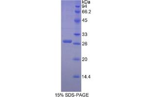 SDS-PAGE analysis of Mouse Ectodysplasin A Protein. (Ectodysplasin A Protein (EDA))