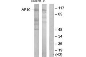 Western blot analysis of extracts from COLO205/Jurkat cells, using AF10 Antibody. (MLLT10 antibody  (AA 211-260))