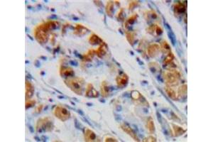 Used in DAB staining on fromalin fixed paraffin-embedded Stomach tissue (ENO1 antibody  (AA 78-241))