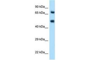 Image no. 1 for anti-Selectin E (SELE) (AA 81-130) antibody (ABIN6746548) (Selectin E/CD62e antibody  (AA 81-130))