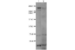 Western Blot of Rabbit Anti-Huntington antibody. (Huntingtin antibody  (N-Term))