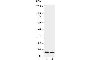 Western blot testing of Resistin antibody and Lane 1:  recombinant mouse protein 10ng;  2: 5ng (Resistin antibody  (C-Term))