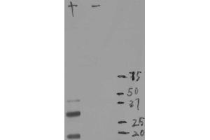 Blot of crude extract of HEK293 cells transfected with pFin-EF1-mCherry vector in lane labeled (mCherry antibody)