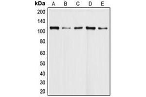 Western blot analysis of DAXX expression in HeLa (A), Molt4 (B), Ramos (C), K562 (D), HEK293T (E) whole cell lysates.