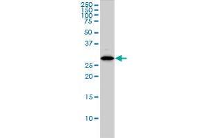 CLIC1 monoclonal antibody (M01), clone 2D4 Western Blot analysis of CLIC1 expression in HL-60 . (CLIC1 antibody  (AA 1-241))