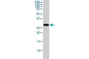 CLIC1 monoclonal antibody (M01), clone 2D4 Western Blot analysis of CLIC1 expression in HL-60 .