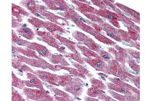 ADCYAP1R1 antibody  (N-Term)