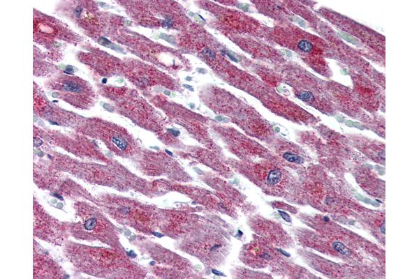 ADCYAP1R1 antibody  (N-Term)