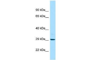 WB Suggested Anti-MAPRE2 Antibody Titration: 1. (MAPRE2 antibody  (C-Term))