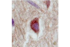 Immunohistochemistry with Brain, cortex tissue at an antibody concentration of 2. (SLC18A1 antibody  (Middle Region))