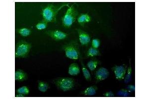 IF analysis of WEE1 using anti-WEE1 antibody (ABIN6719614). (WEE1 antibody)