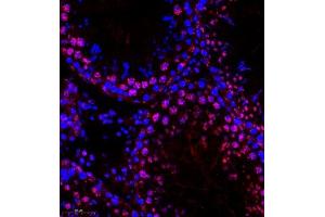 Immunofluorescence of paraffin embedded rat testis using HOXC9 (ABIN7074251) at dilution of 1:650 (300x lens) (HOXC9 antibody)
