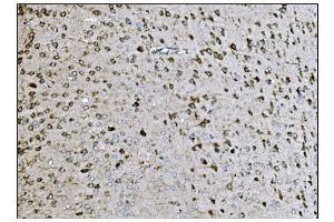 IHC analysis of LRP1B using anti-LRP1B antibody (ABIN7601521). (LRP1B antibody  (AA 3704-4547))