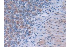 Detection of TSK in Mouse Stomach Tissue using Polyclonal Antibody to Tsukushin (TSK) (TSKU antibody  (AA 30-307))
