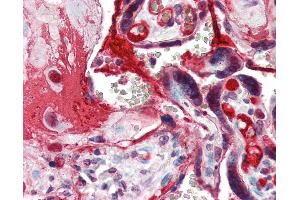 Anti-CCNE1 / Cyclin E1 antibody IHC of human placenta. (Cyclin E1 antibody  (C-Term))