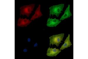 ABIN7095474 and ABIN7099531 staining  cells by IF/ICC. (BRD9 antibody)