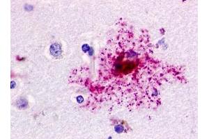 Immunohistochemical staining of Brain (Astrocyte) using anti- GPR84 antibody ABIN122097 (GPR84 antibody)