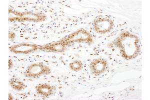 anti-Translin-Associated Factor X (TSNAX) (AA 240-290) antibody