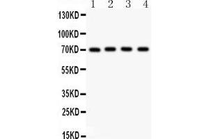 Anti- NRG1 Picoband antibody, Western blottingAll lanes: Anti NRG1  at 0. (Neuregulin 1 antibody  (AA 2-241))